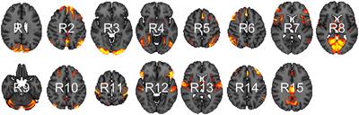 Frontiers Multivariate Heteroscedasticity Models for Functional